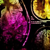 Colorful,X-ray,Scan,Of,Brain